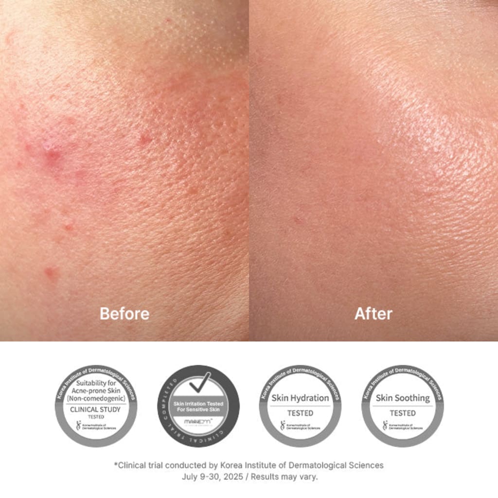 Calm-Barrier Cream